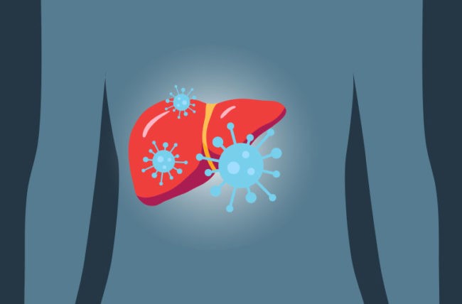 Hepatitis, un virus silente