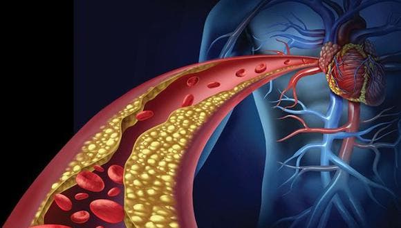 Potenciar un mecanismo celular puede prevenir la obstrucción de las arterias