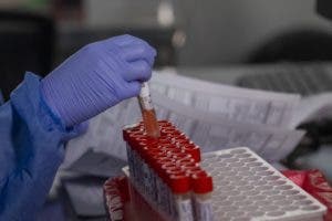 Identifican medicina para el hígado que puede prevenir la covid