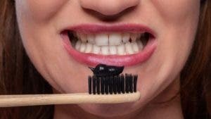 Odontólogo alerta sobre modas peligrosas en los dientes