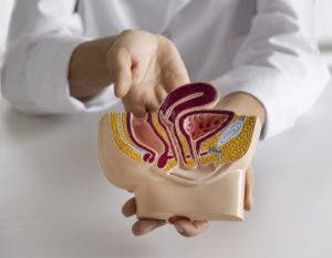 Cáncer de colon causas, síntomas y tratamiento