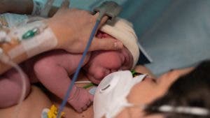 La covid puede cruzar la placenta y causar daños cerebrales en recién nacidos