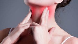 Cáncer de garganta: ¿por qué el sexo oral puede ser un factor de riesgo?