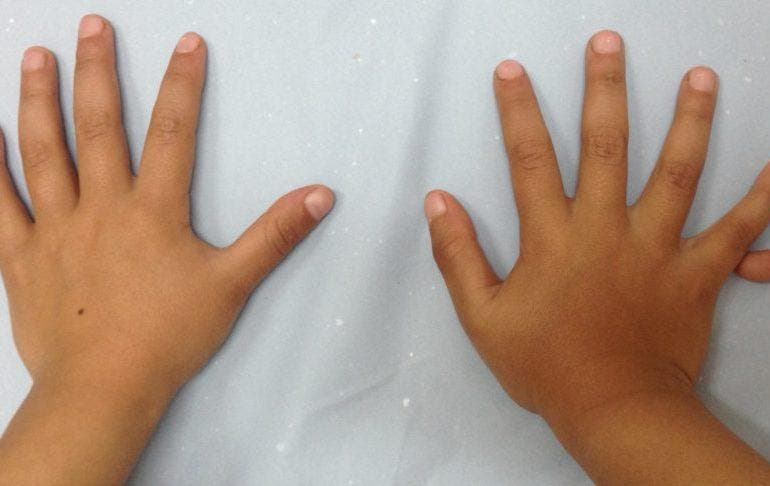 Anuncian jornada médica en favor de niños que padecen malformación congénita