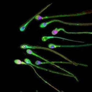 La covid disminuye la calidad del semen a largo plazo, según un estudio