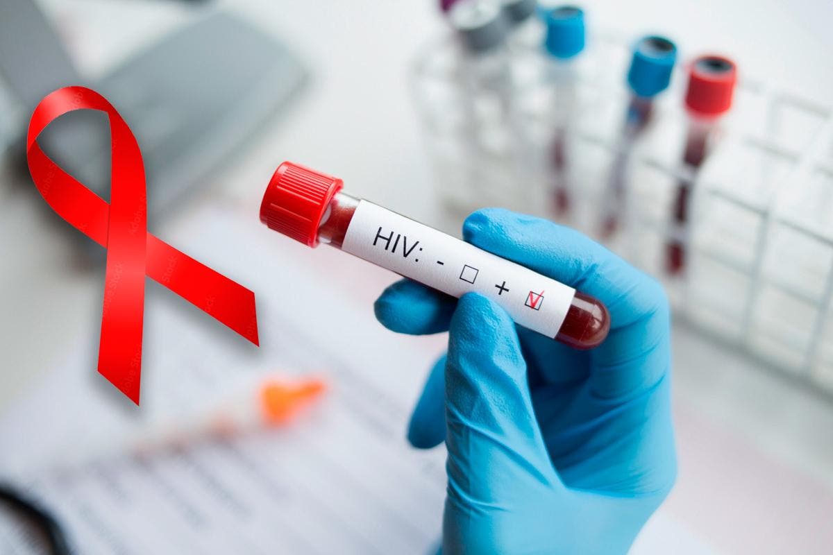 Aumentan los casos de personas infectadas con  VIH en el país