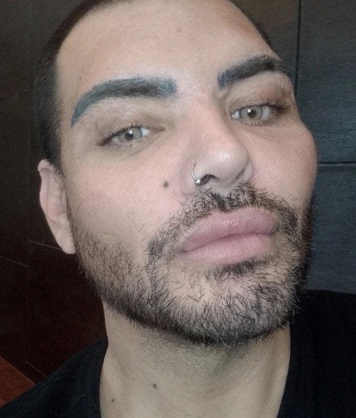 Hombre se somete a más de 30 cirugías para parecerse a Ricky Martin