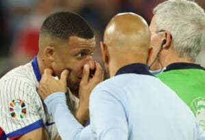 Mbappé sufre fractura de nariz y será operado en hospital de Dusseldorf