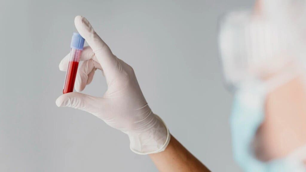 Un análisis de sangre podría predecir el párkinson 7 años antes de los síntomas