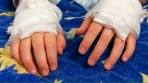 Coerción a mujer quemó manos de su hijo, será este lunes