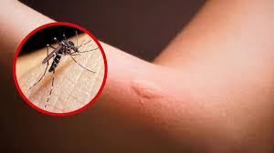 Reportan la primera muerte del año por dengue en Puerto Rico