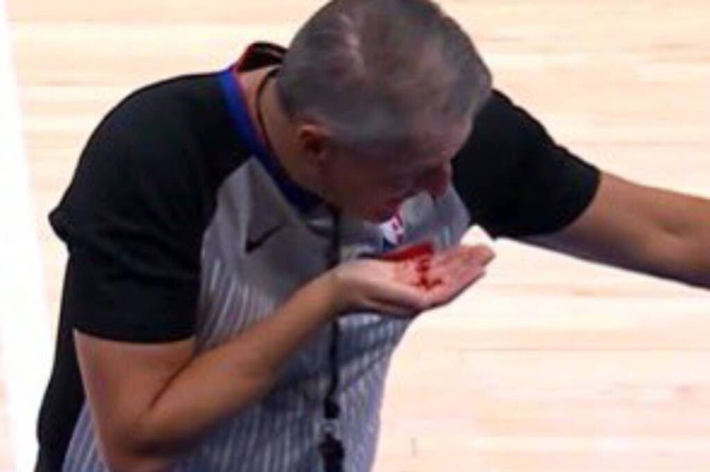 Árbitro NBA sangra tras golpe en juego