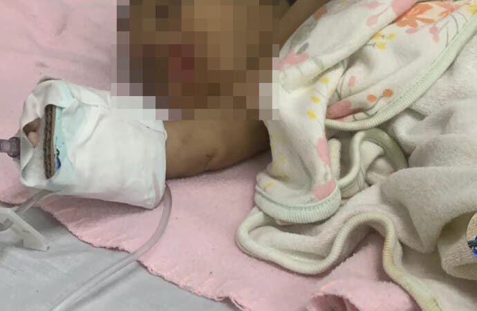 Indignante: Bebé en estado crítico tras brutal maltrato de su madre