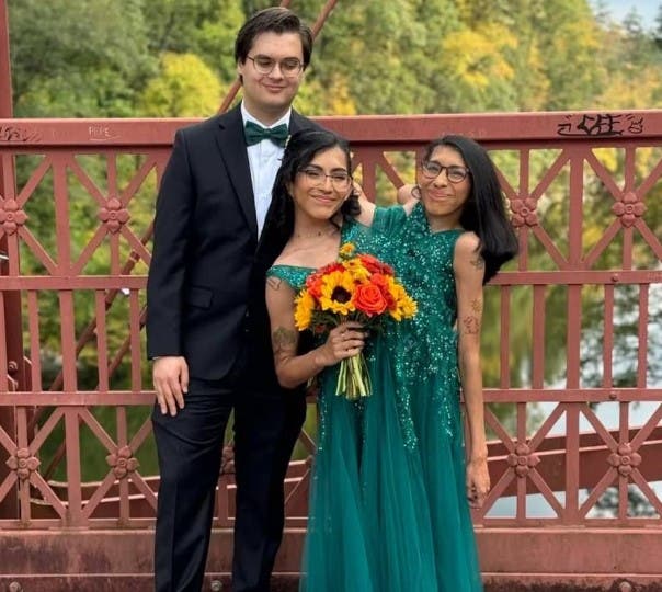 Siamesas Carmen y Lupita aclaran dudas sobre su intimidad tras el casamiento de una
