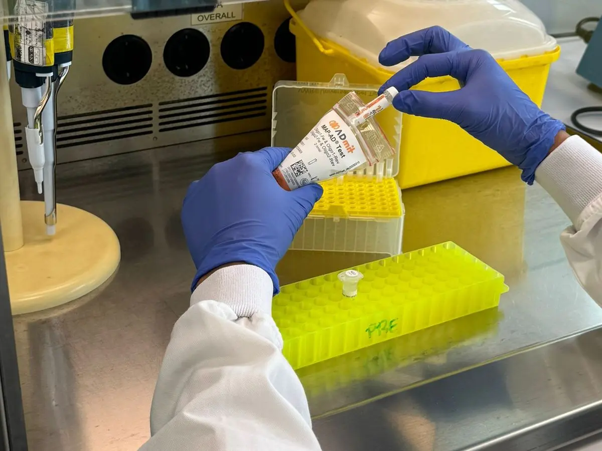 Hallazgo: Científicos podrían detectar temprano el Alzheimer
