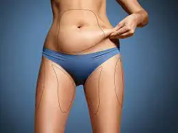 Liposucción 5K: eficiencia y recuperación rápida en cirugía plástica