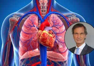 Recomiendan prueba antes de los 40 para disminuir el riesgo de sufrir un infarto