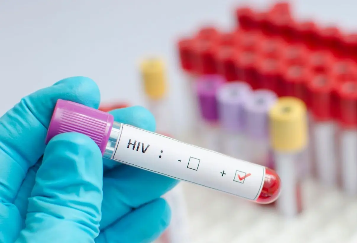 El 26.9% los pacientes con VIH en República Dominicana son haitianos