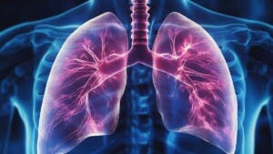 Innovación y diagnóstico temprano: claves para la salud pulmonar en América Latina