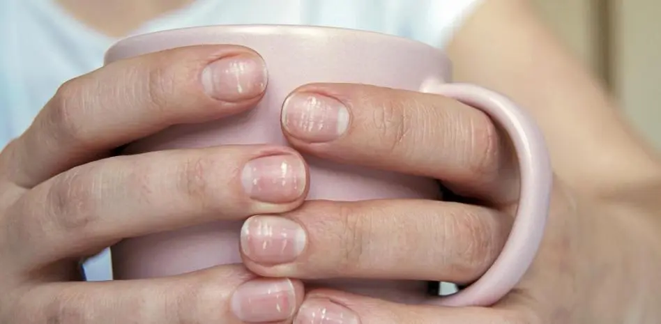 La salud también se refleja en las uñas: señales que no debes ignorar
