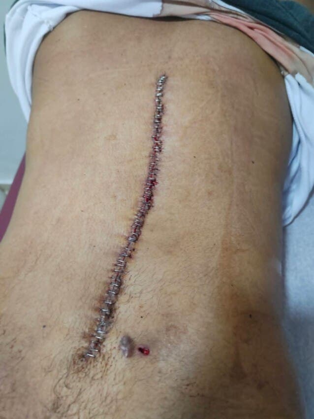 Elías Manuel Rodríguez enfrenta una compleja lucha por su salud que se extiende por más de cuatro años