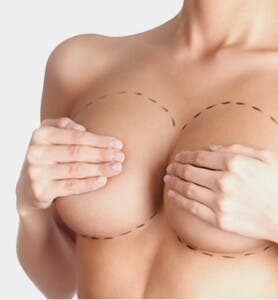 Mamoplastía de reducción mejora la salud y calidad de vida de mujeres, dice especialista