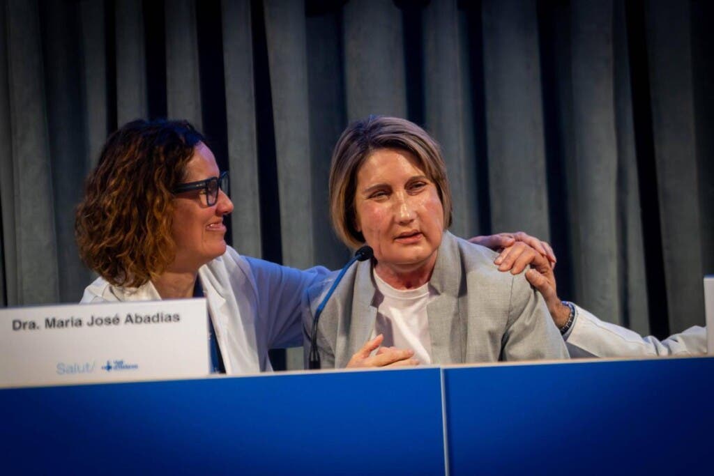 Realizan en España primer trasplante de cara con donante de eutanasia