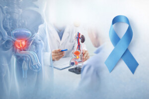 ¿Cómo afectan las vesículas adiposas al cáncer de próstata?