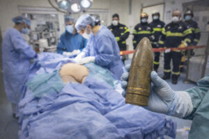 ¡Insólito! Extraen un obús de la I Guerra Mundial del recto de un joven en Francia