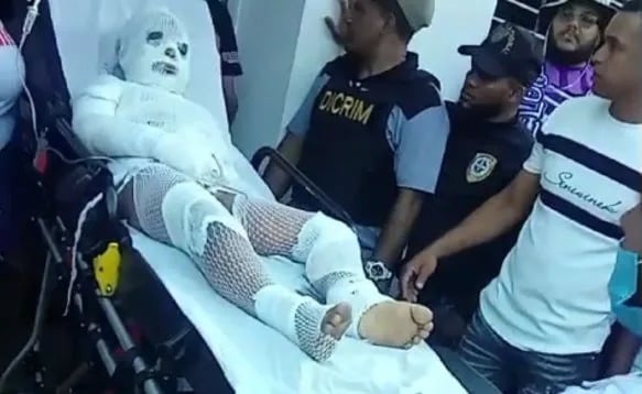 Hombre quema a su hermano tras discusión en Santiago