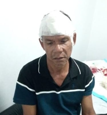 Conflicto familiar termina en tragedia: coronel mata a su hermano