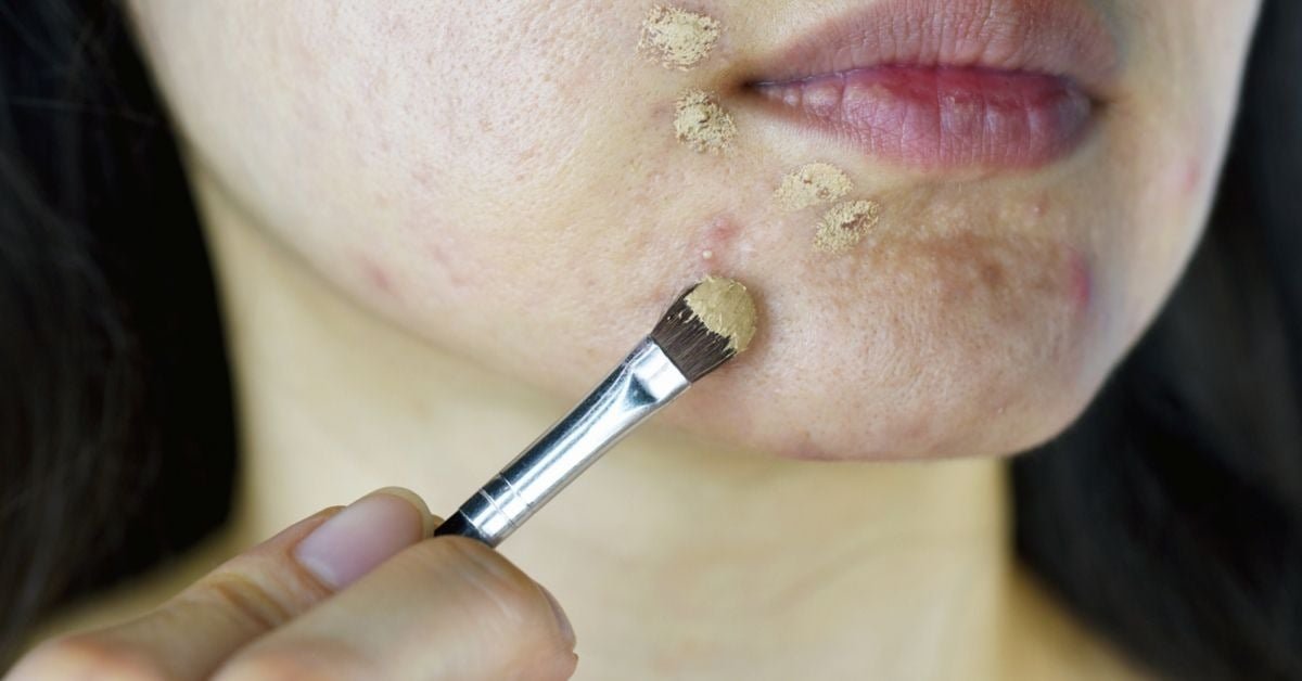 ¿Cómo el maquillaje puede provocar acné?