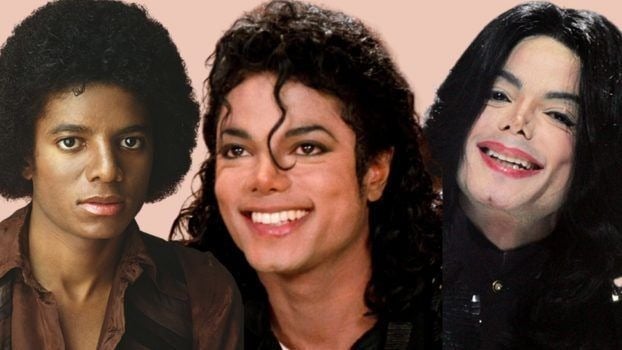 “Él no quería ser blanco”: sobrino de Michael Jackson atribuye cambios al vitiligo