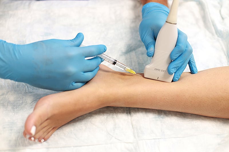 Alertan sobre el avance de las enfermedades venosas en República Dominicana