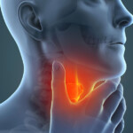 Tumores de cabeza y cuello: señales de alerta que no debes ignorar