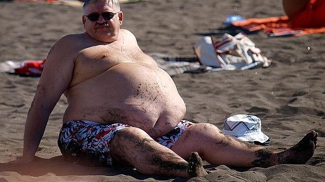 La obesidad deja una marca en el sistema inmunitario hasta diez años después