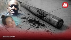 Mujer pierde el bazo tras ser atacada con un bate por su pareja en Moca