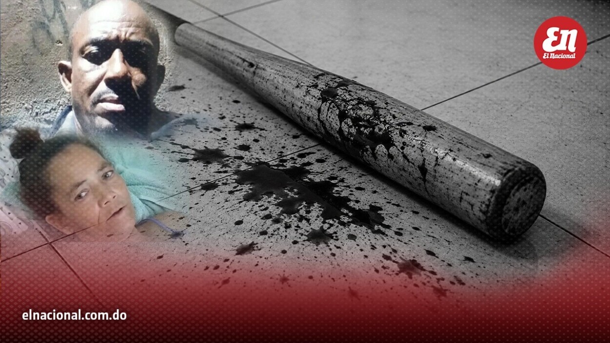 Mujer pierde el bazo tras ser atacada con un bate por su pareja en Moca