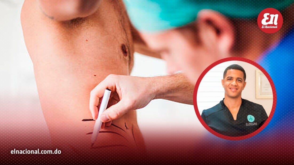 Botox, lipo y blefaroplastia: los tratamientos estéticos favoritos de los hombres