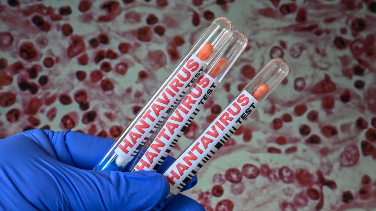 Crisis de hantavirus: 11 casos y bajo riesgo según la OMS