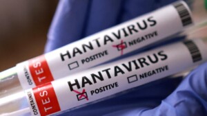 Argentina pone a disposición pruebas de hantavirus a países afectados por brote en crucero